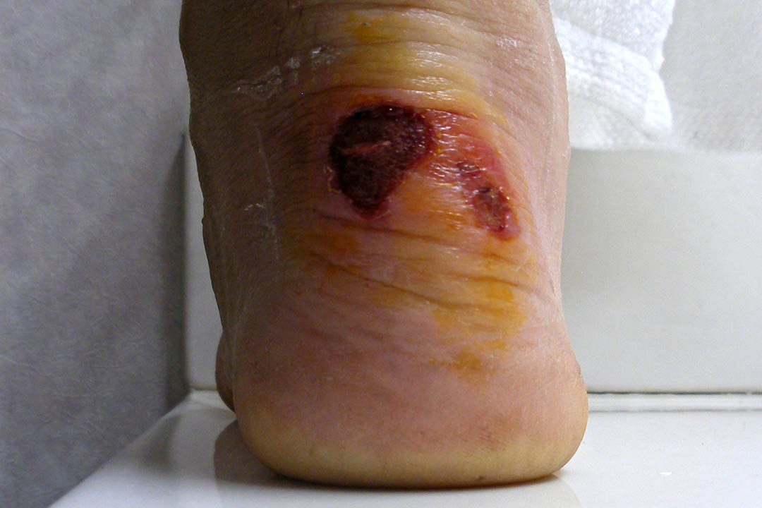 Click to access High Resolution image